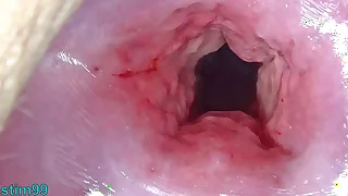Uncensored Japanese Cervix Flourishing coupled back Uterus Dilation back Penetration